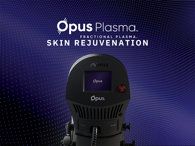 Opus Plasma in Marshall IL