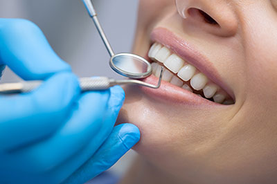 Marshall IL Dental Checkups