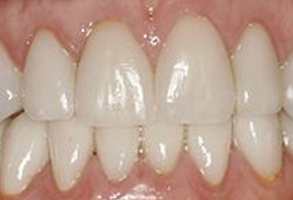 Cosmetic Dentist near Marshall IL